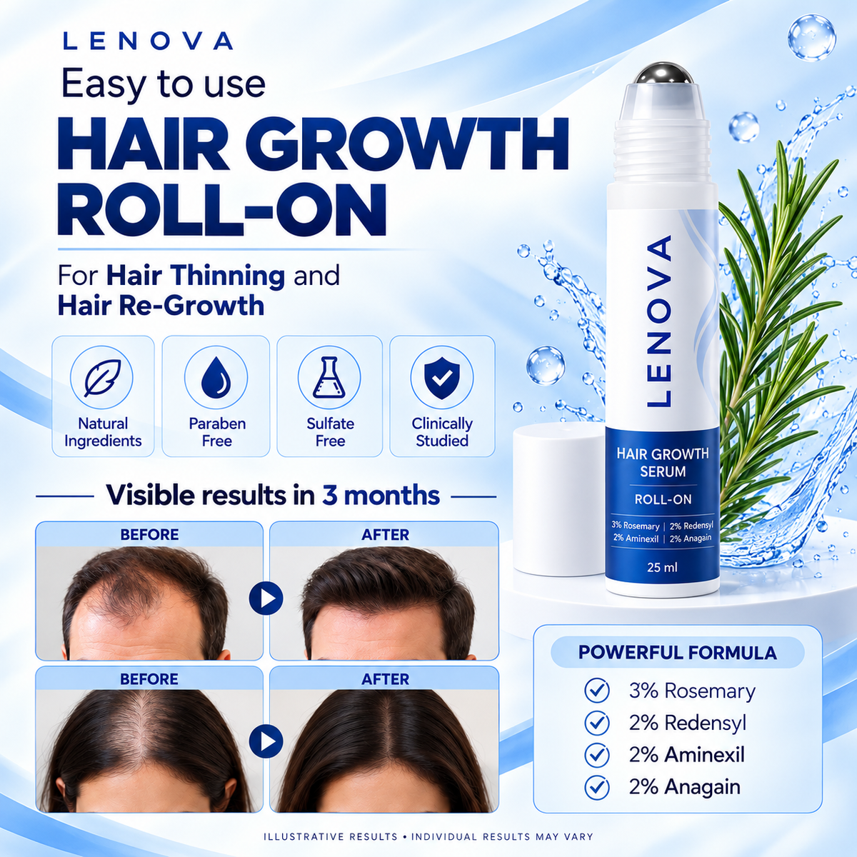 Hair Growth Serum
